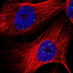 GBE1 Antibody, Novus Biologicals:Antibodies:Primary Antibodies